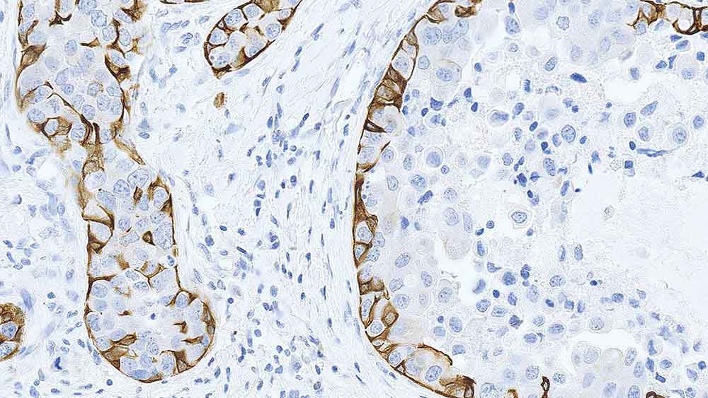 cytokeratin 5 xm26 pa0468