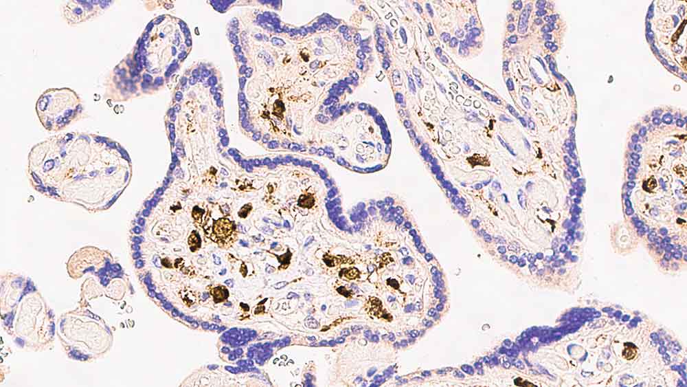 factor xiiia blood coagulation factor xiiia e980.1 pa0449